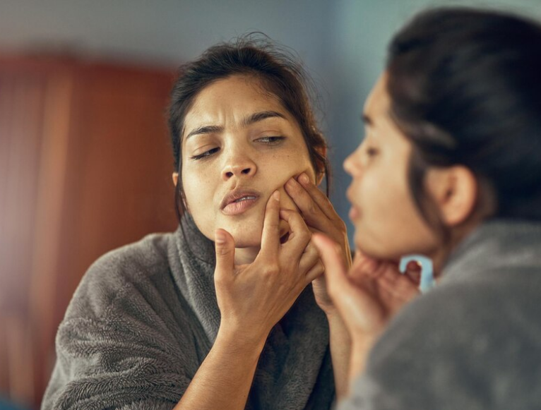 common-mistakes-when-using-pigmentation-cream-and-how-to-avoid-them-dermatouch