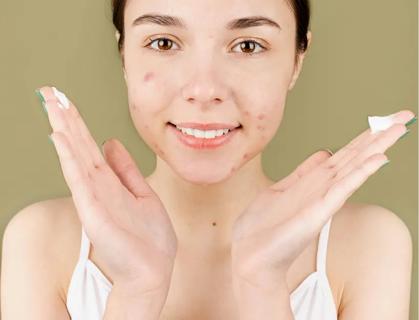 need-a-dark-spot-remover-discover-top-picks-and-solutions-dermatouch