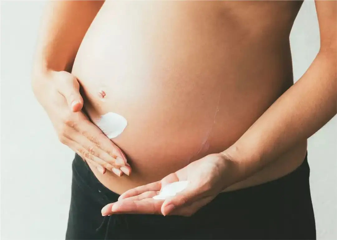 How to Treat Stretch Marks During Pregnancy