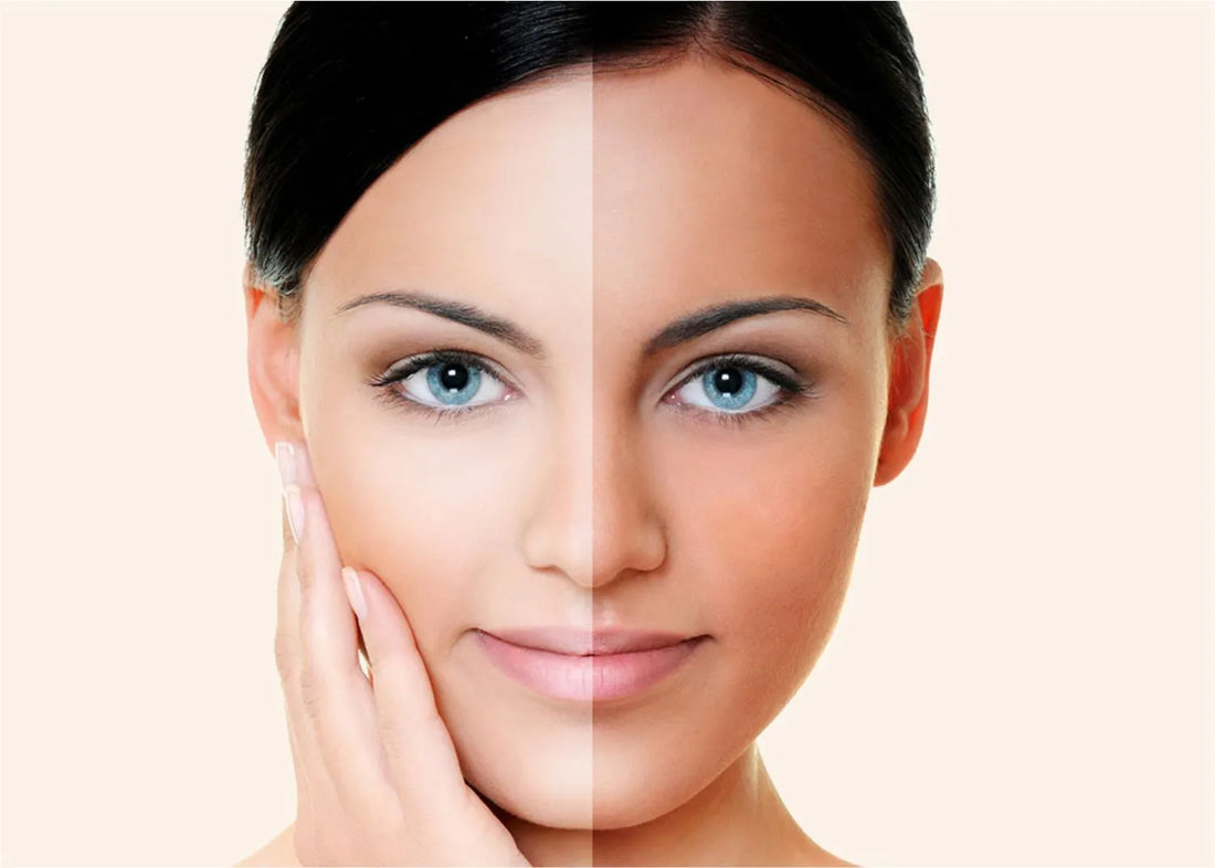 How to reduce tan on face