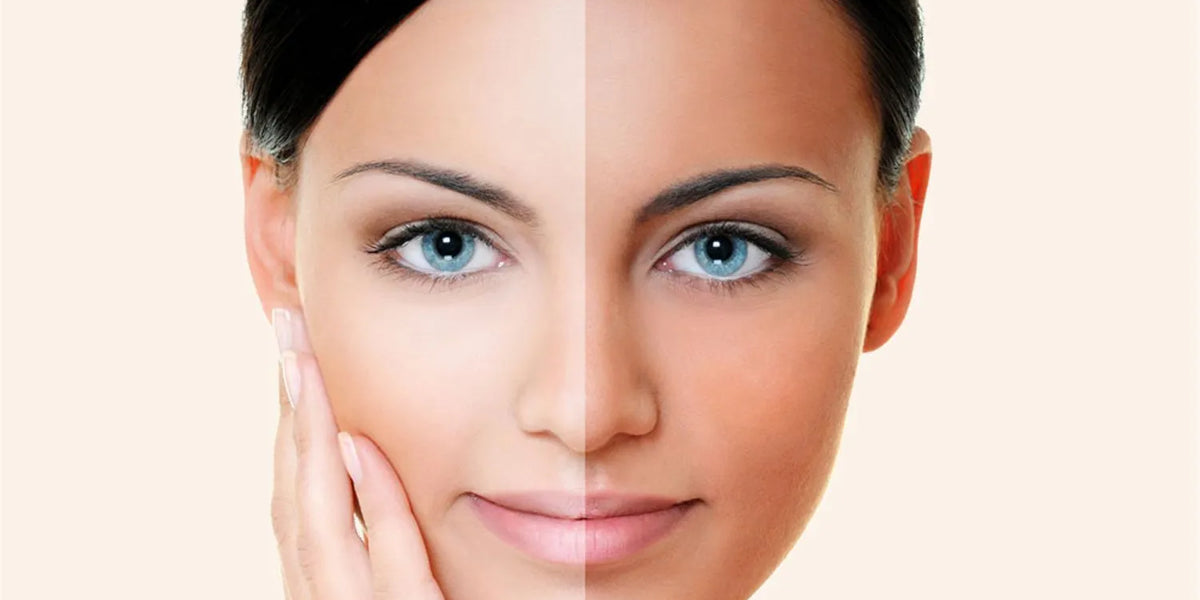 How_to_reduce_tan_on_face_1501x1072_crop_center_1b6d758202cb4bd984da73fbd9465603_1200x600