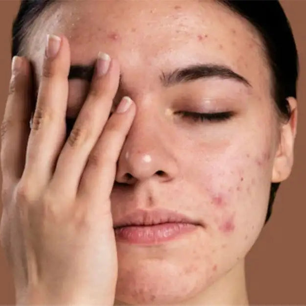 How to remove dark spots on face fast
