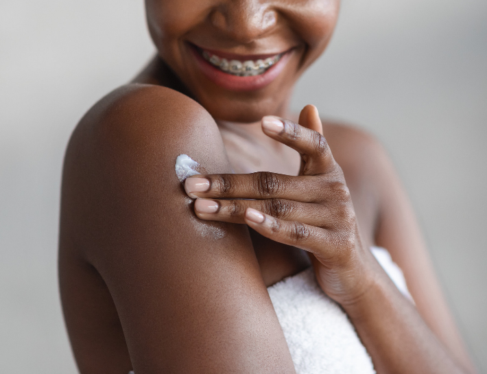 How to Prevent and Heal Stretch Marks with Dermatologist-Approved Creams