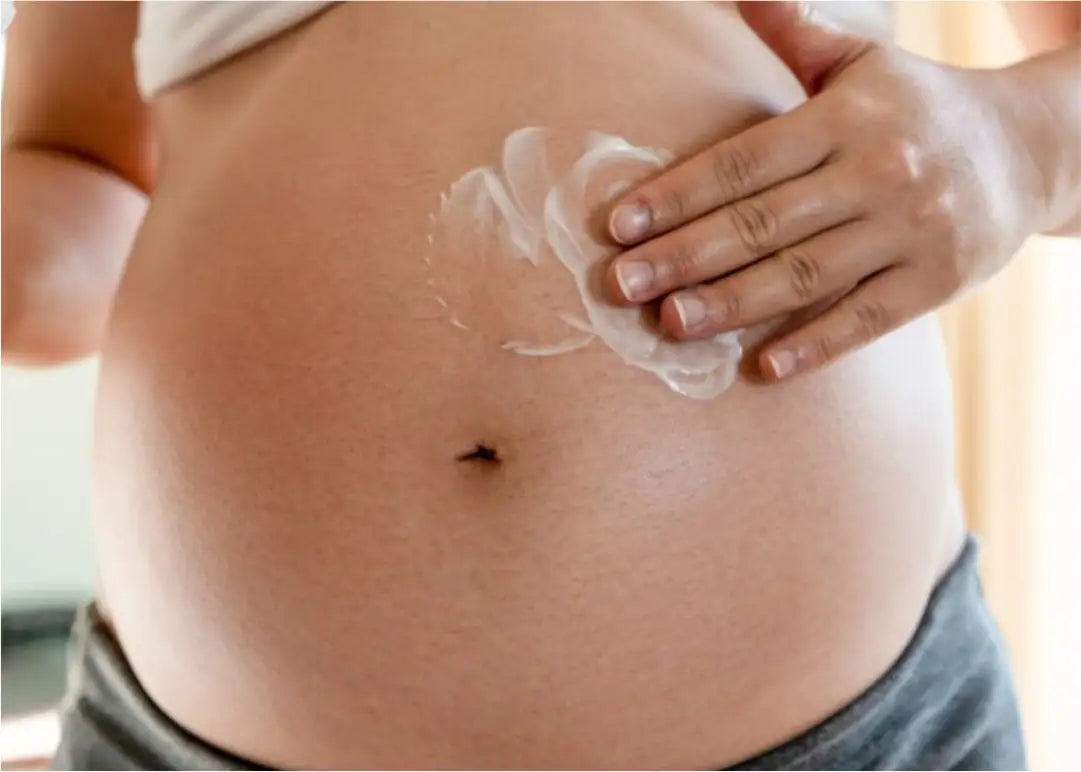 Tips for Avoiding Stretch Marks While Pregnant