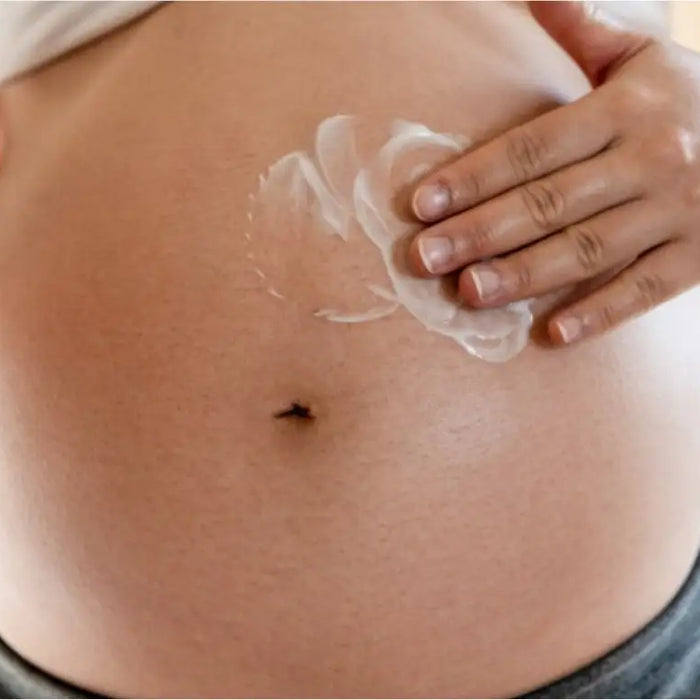 Tips for Avoiding Stretch Marks While Pregnant