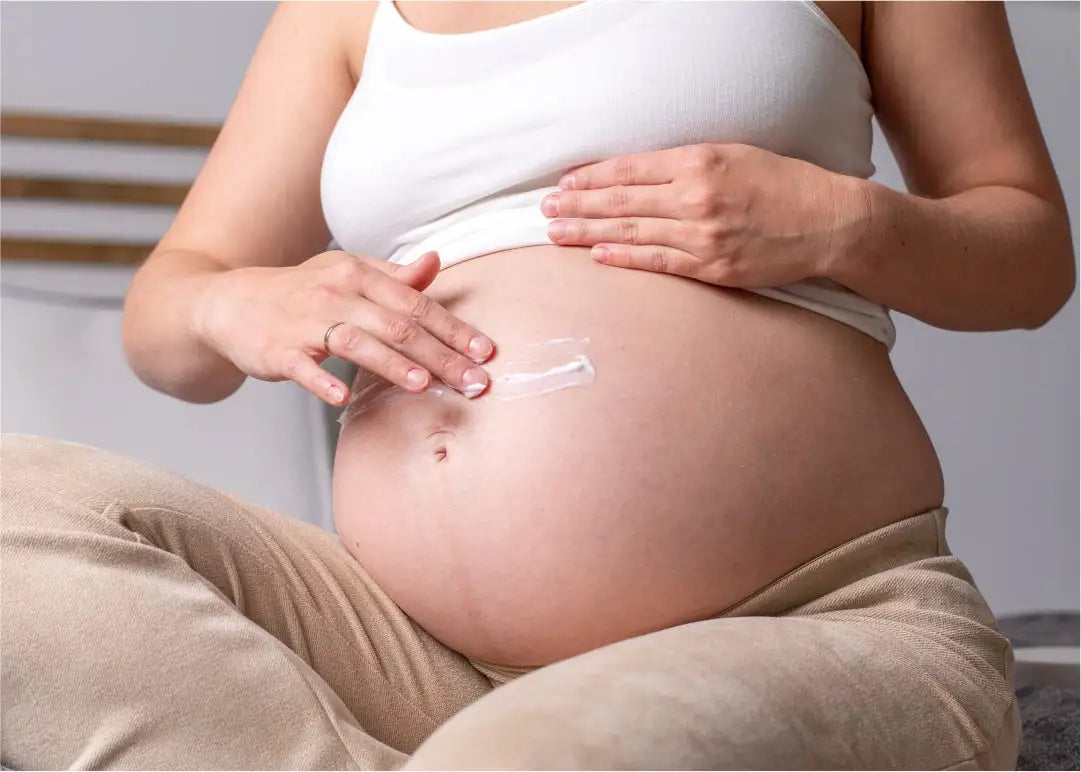 You Need to Know About Pregnancy Stretch Marks