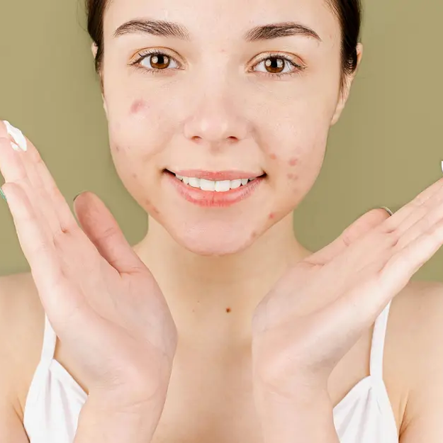 Need a Dark Spot Remover? Discover Top Picks and Solutions
