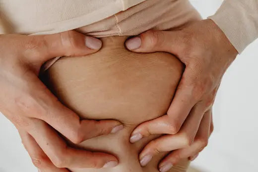 What are the Best Creams in India to get rid of Stretch Marks?