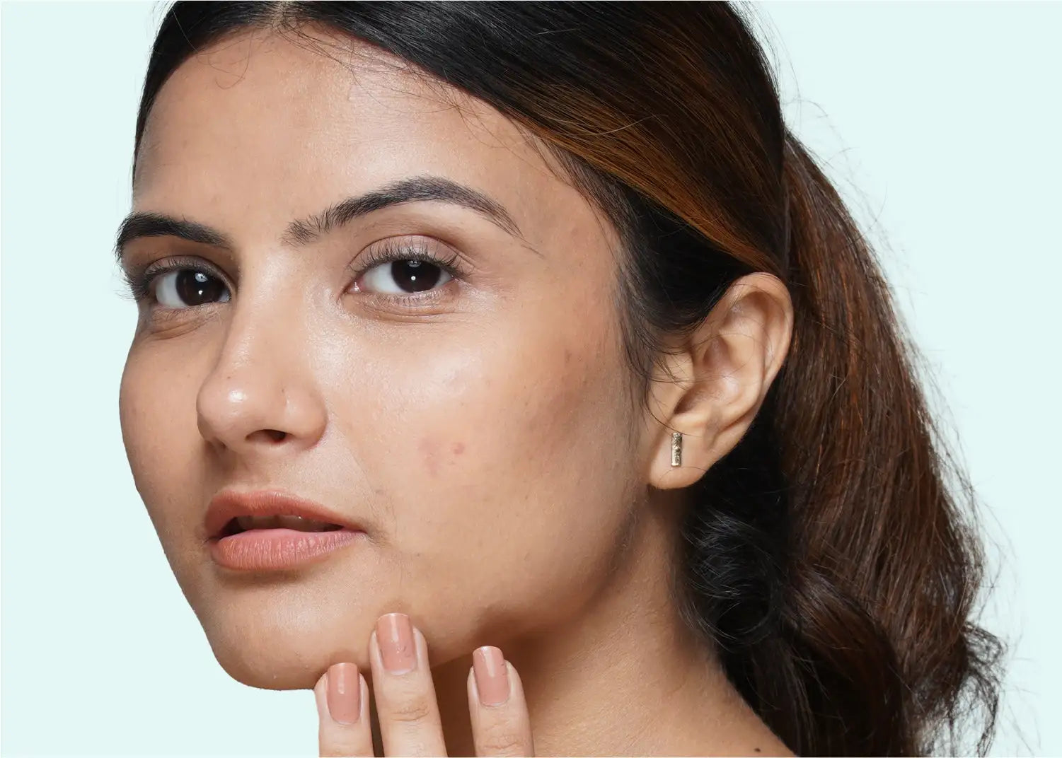 How to remove pimple marks overnight?