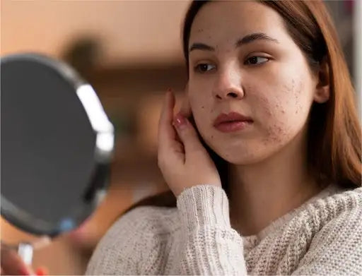 Skincare Mistakes You Should Avoid