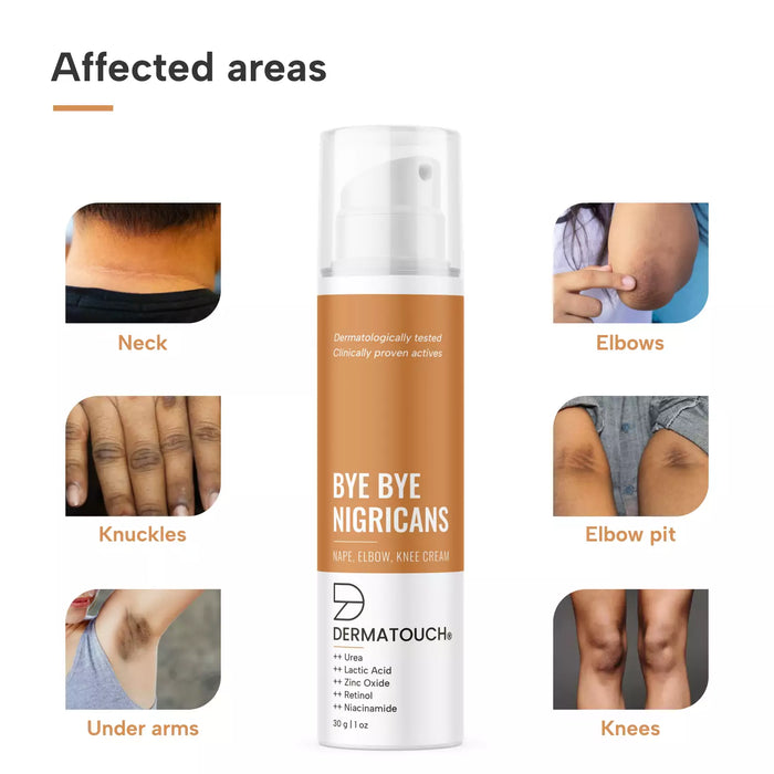 affected areas for cream