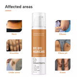 affected areas for cream