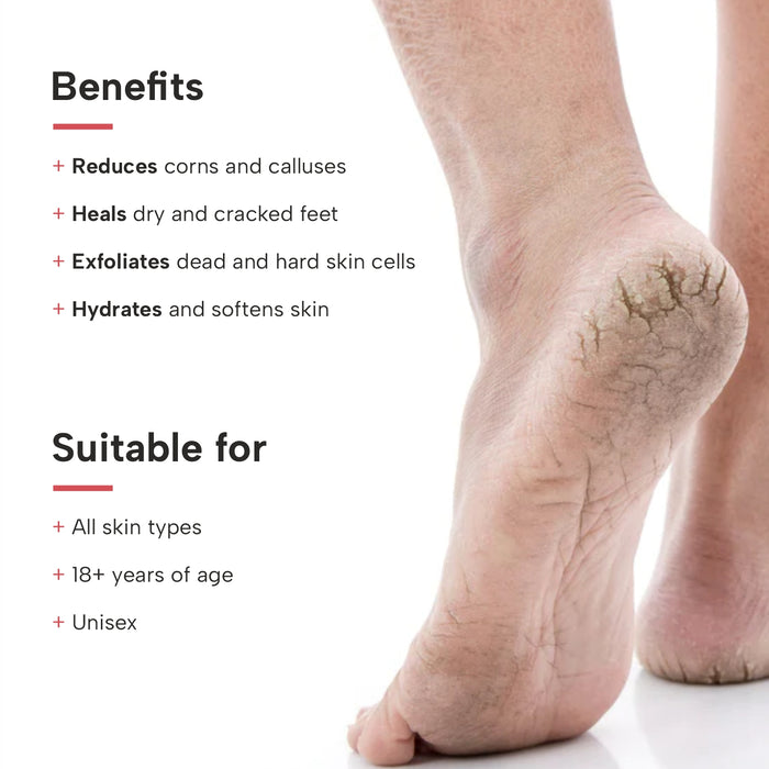 Urea Cream 40% For Dry Cracked Heel Repair Softening Foot Cream | eBay