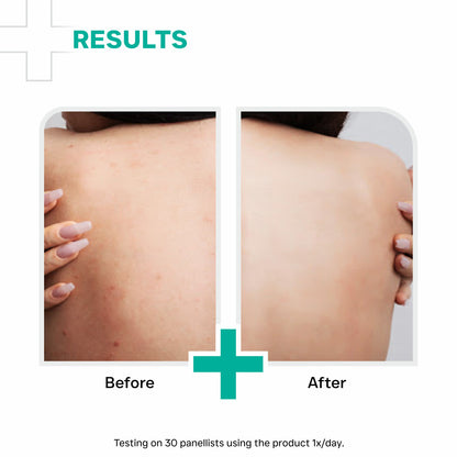 AHA 10% BHA 1% Body Lotion