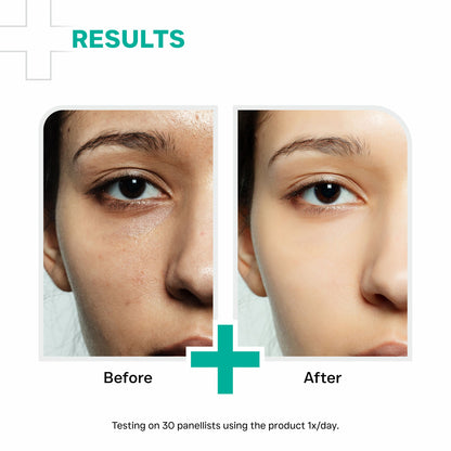 नियासिनमाइड 10% सीरम - 30ml