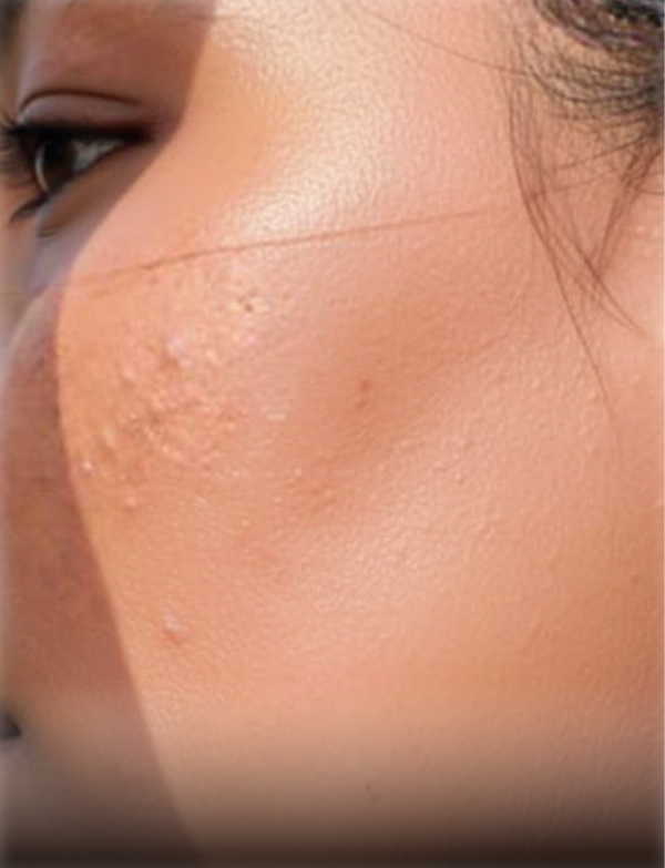 Sun Protection skincare concern